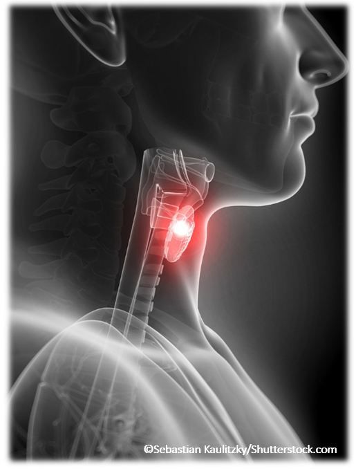 Subclinical Thyroid Disease When To Treat And How