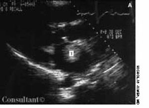 A Better Way to Assess for Renal Insufficiency?