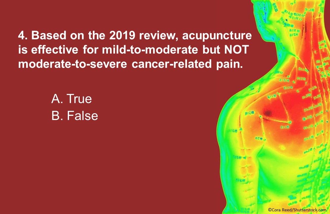 Acupuncture for the Management of Cancer Related-Pain