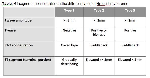 Brugada syndrome types 