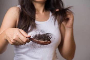 Nektar Therapeutics Completes Enrollment for Phase 2b Alopecia Areata Trial / Image credit: ©Siam/AdobeStock