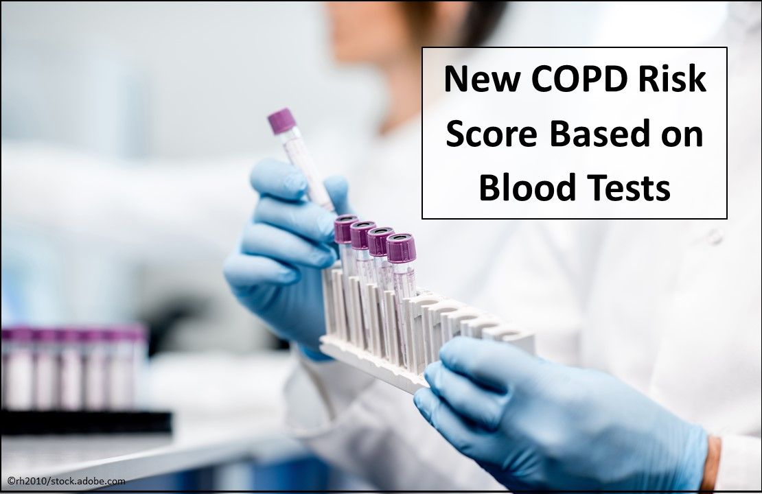 COPD risk score, new COPD risk score based on blood test, COPD new research 