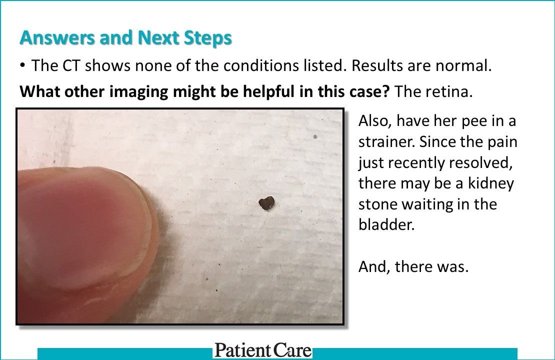 flank pain, kidney stones, renal complications, gall stones