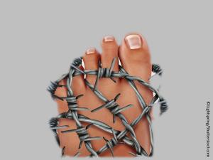 All About Gout for Primary Care: Treating Acute Gout