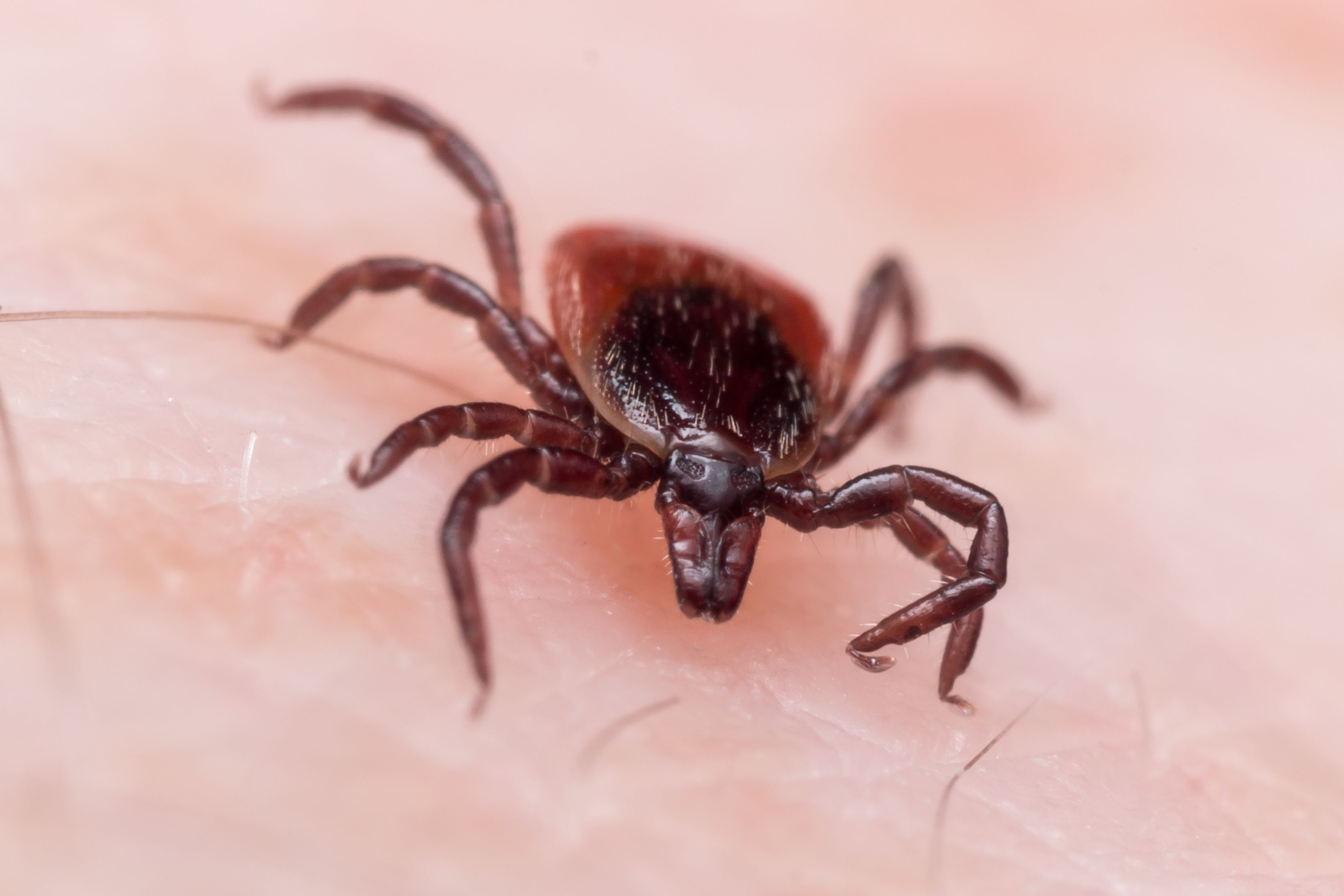 Lyme Disease A Catchup Quiz