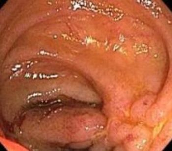 (Courtesy David Schwartz, MD)