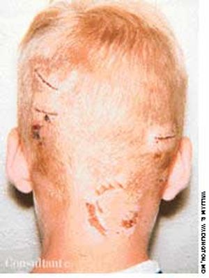 Friendly Dog Syndrome