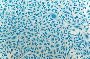 Urine based cervical cancer screening tested in world's largest trial © heitipaves/stock.adobe.com