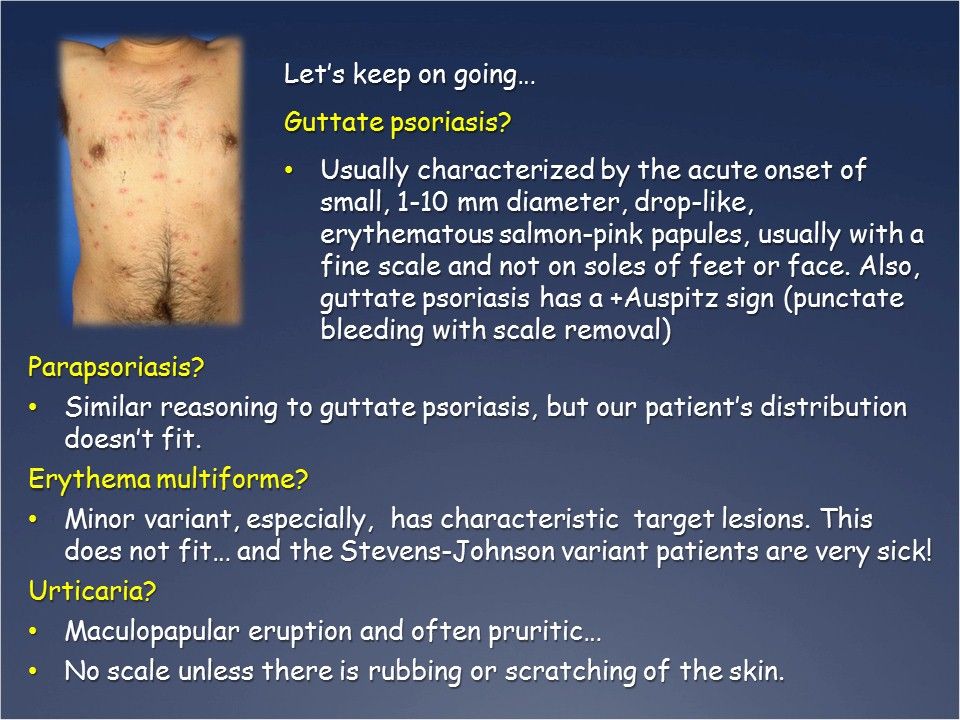 A Suspicious Scaly Rash on a Young Sailor Patient Care