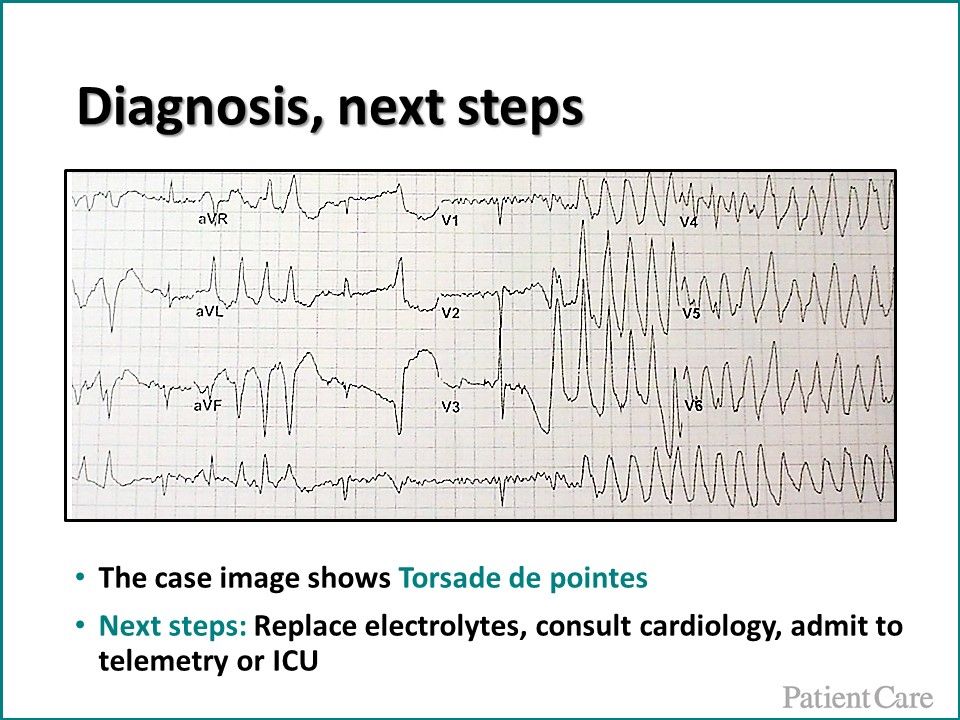 Torsade de pointes, ventricular tachycardia