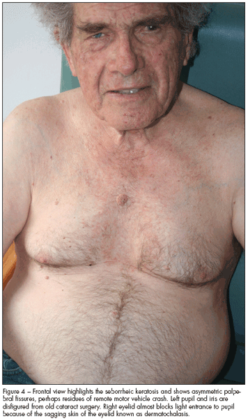Old Man Nipples | Gay Fetish XXX