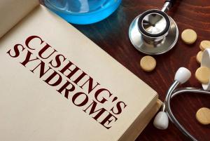 Cushing Syndrome: A Primer for Primary Care Clinicians / image credit ©Vitalii Vodolazskyi/stock.adobe.com
