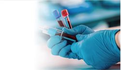 Novel Liquid Biopsy for NASH is Highly Accurate, Sensitive, Specific, and Reliable