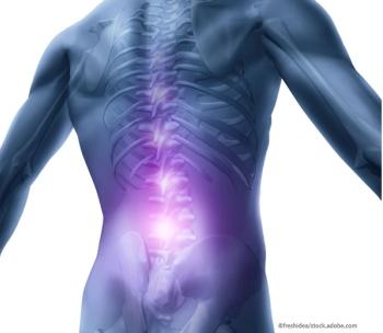 risk factors for and diagnosis of acute low back pain 
