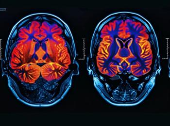 Precision Medicine Protocol for Cognitive Decline Also Reduces Depression, New Data Suggest image credit ©Maxim/stock.adobe.com