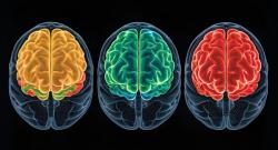 EMA Advisory Group Issues Positive Opinion on Lilly's Donanemab for Treatment of Early Alzheimer Disease 