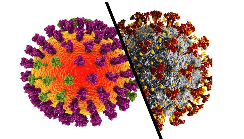 Covid-19 complications worse than influenza complications in hospitalized patients 