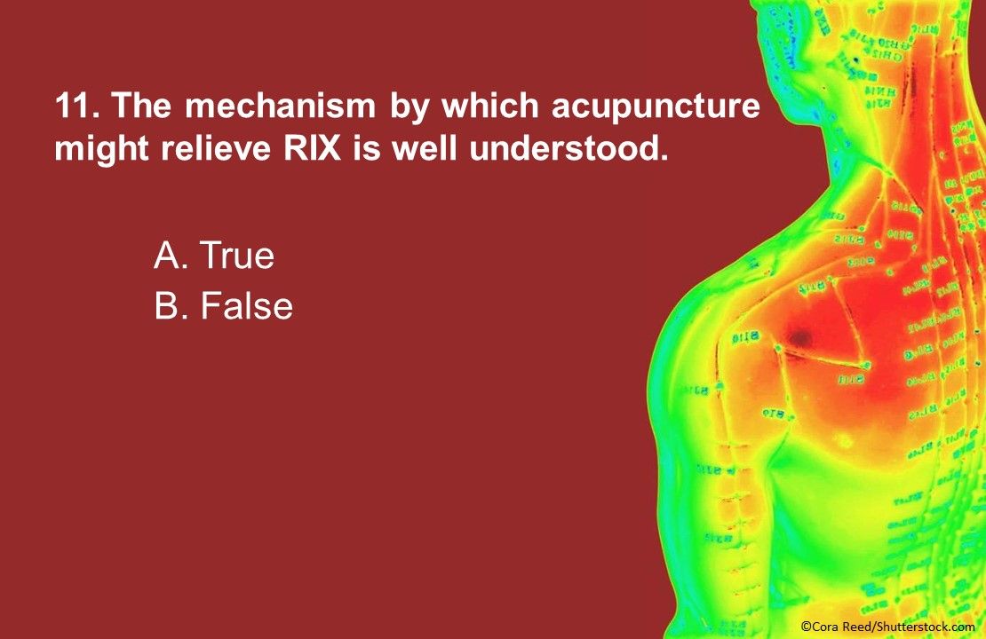 Acupuncture for the Management of Cancer Related-Pain