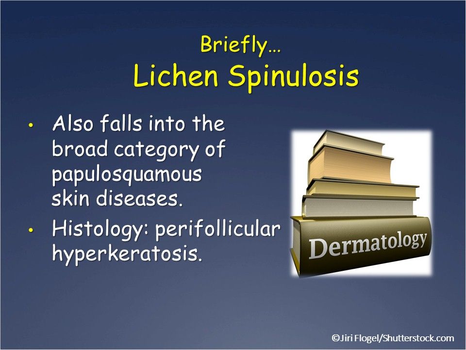 Lichenoid Eruptions: Lichen nitidus, lichen spinulosis, lichen striatus