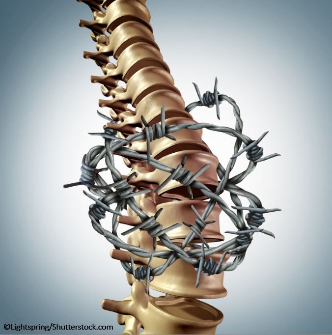 Low Back Pain And Headache Pain Practice Update Low Back Pain And Headache Pain Practice Update