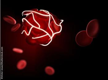 Asundexian Granted FDA Fast Track Designation for Stroke Prevention in Patients with AF blood clot ©Victor Josan/Shutterstock.comJason
