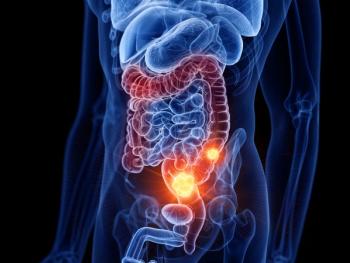 Colorectal Cancer Incidence Has Increased Among Men, Not Women, According to Recent Study / Image credit: ©SciePro/AdobeStock