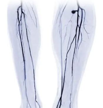 First Rivaroxaban Generics (2.5 mg) Get FDA Approval / image credit ©samunella/stock.adobe.com