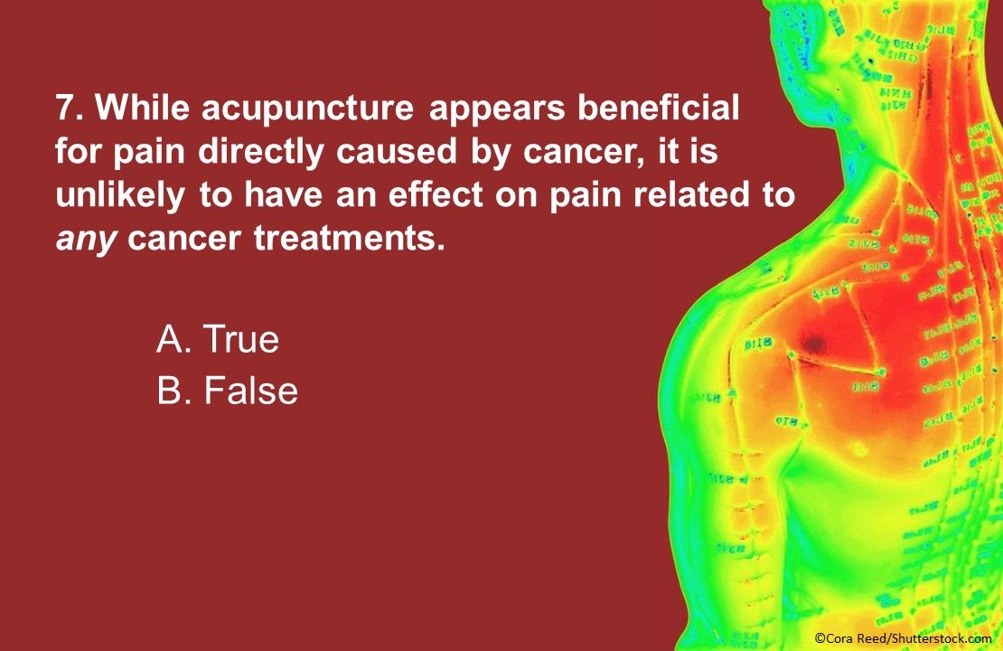 Acupuncture for the Management of Cancer Related-Pain