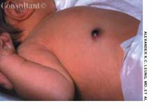 Jumping to Conclusions About Appendicitis