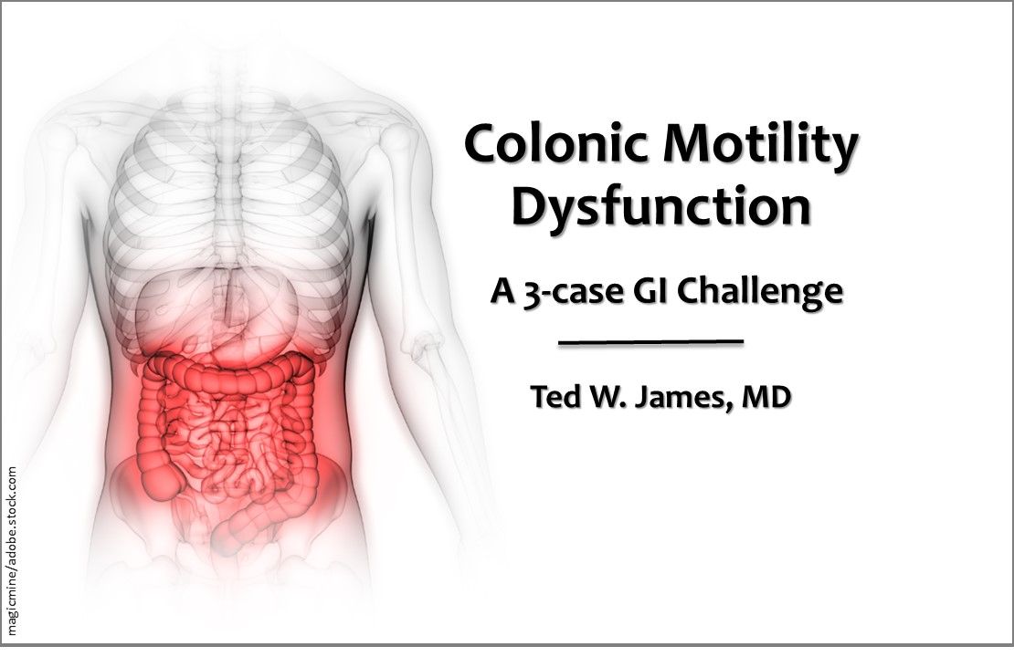 Colon Dysfunction Colonic Motility Dysfunction: 3 Cases on Cause, Effects, Treatment