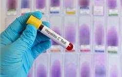 CDC Updates HCV Screening Guidelines to Increase Linkage to Care 