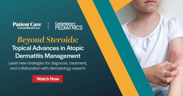 Beyond Steroids: Topical Advances in Atopic Dermatitis Management