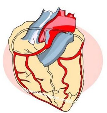 GLP-1 RA, cardioprotection