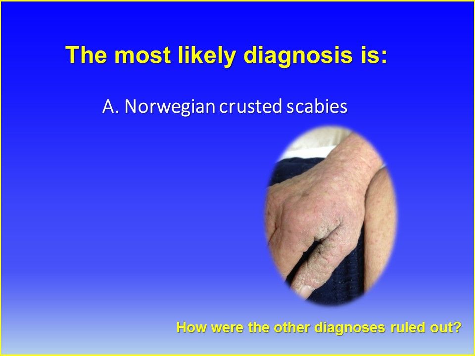 A Confluent, Crusty Rash