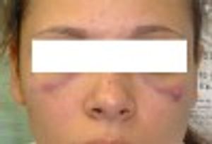 Domestic Violence-and Hidden Child Abuse?