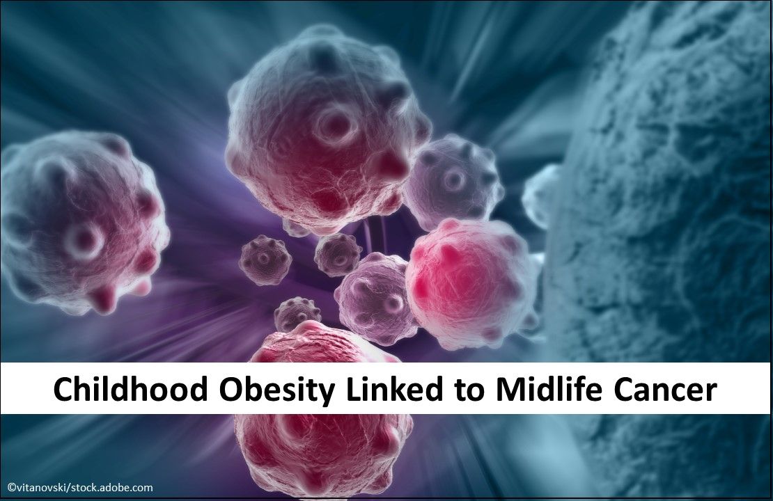 Childhood Obesity Linked to Midlife Cancer Risk
