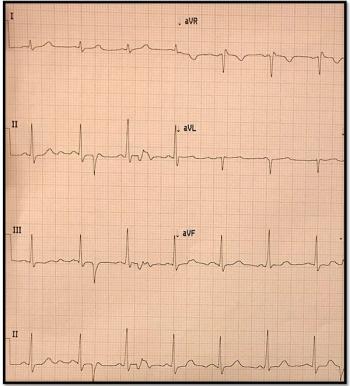 ©Brady Pregerson/Shutterstock.com