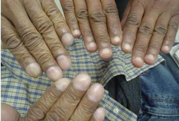 ©Brady Pregerson, MD