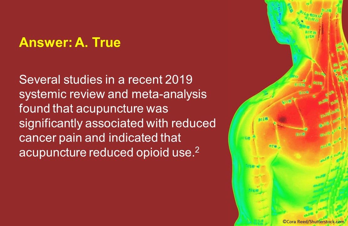 Acupuncture for the Management of Cancer Related-Pain