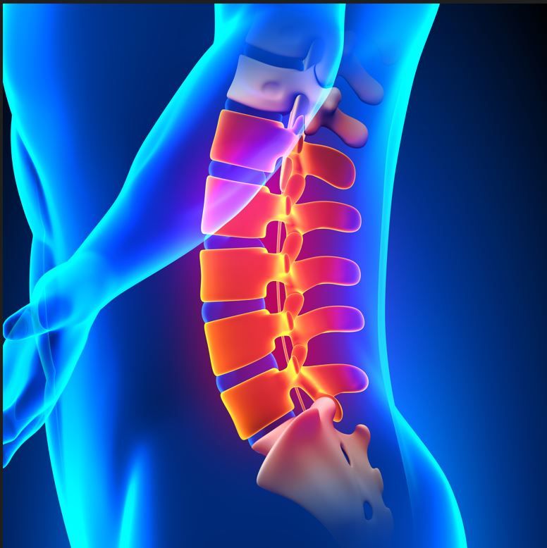 Vertex Nonopioid Analgesic on Par with Placebo in Phase 2 Study of Lumbosacral Radiculopathy  / image credit ©decade3D/stock.adobe.com