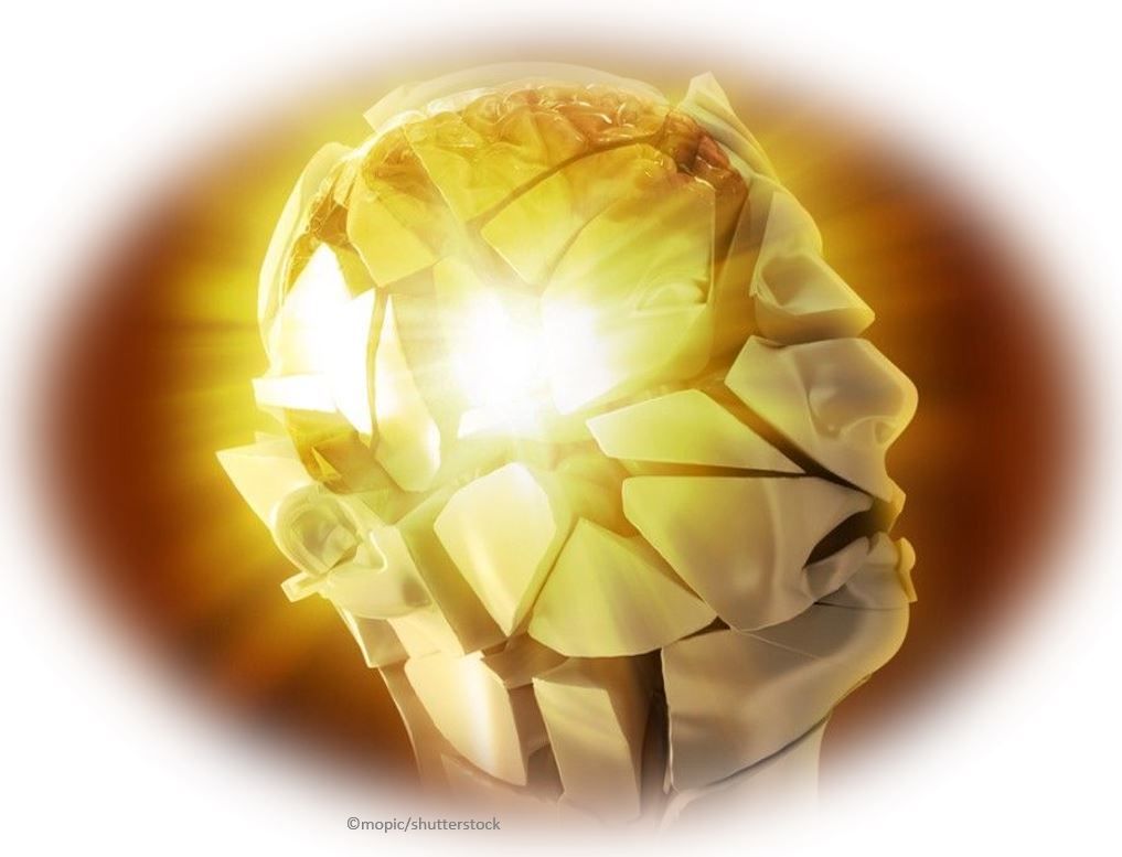  Atogepant Superior to Topiramate for Migraine Prevention in Phase 3 Head-to-Head TEMPLE Study / image credit ©mopic/shutterstock.com