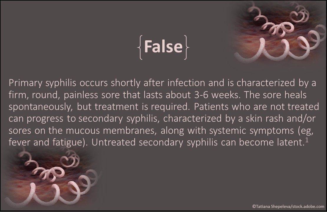 primary syphilis, syphilis sore in mouth, primary syphilis symptoms, syphilis