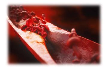 AHA 2019 results of ORION trial twice-yearly inclisiran cut LDL-C by half