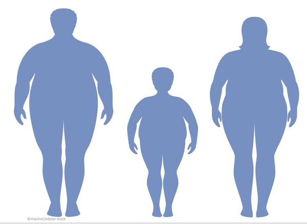Obesity Still Plagues the US, But Rates Are Declining in Some States: Trust for America's Health Report/ image credit ©Mashot/stock.adobe.com