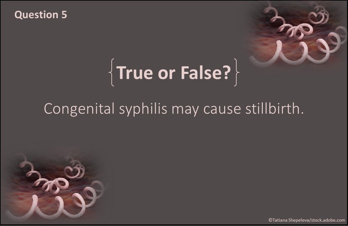 Congenital syphilis, congenital syphilis may cause stillbirth, 