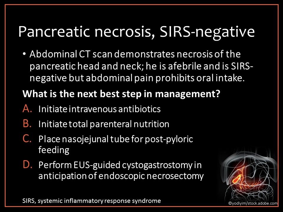 Pancreatic necrosis, nasojejunal feeding, post-pyloric tube