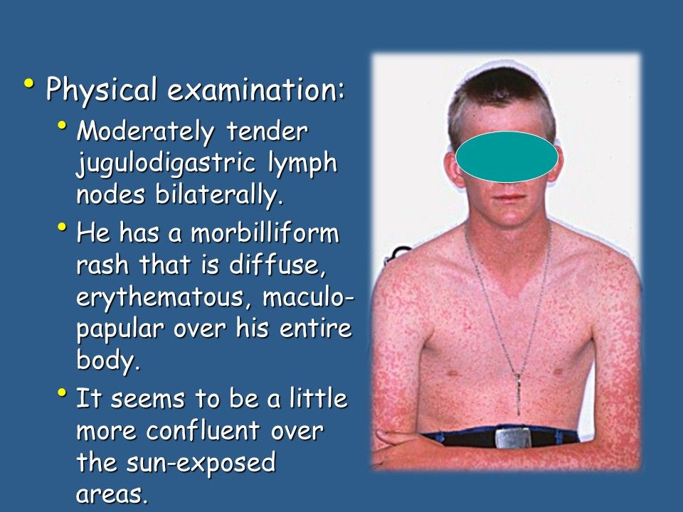 Diffuse Morbilliform Rashes Sore Throat and Widespread Rash in a Young Sailor