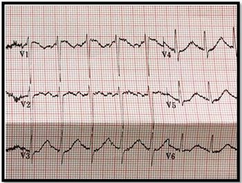 Copyright Brady Pregerson, MD