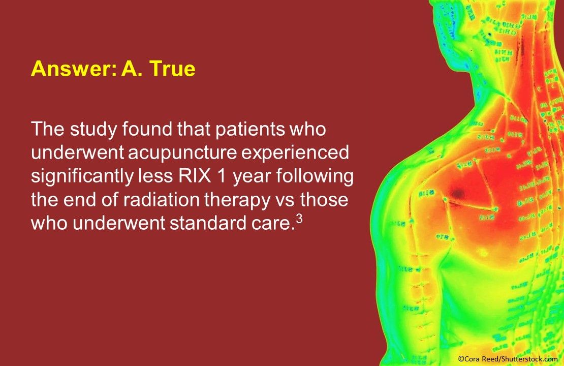 Acupuncture for the Management of Cancer Related-Pain