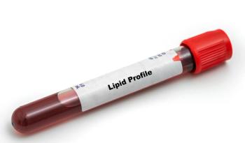 ©luchschenF/stock.adobe.com